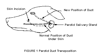 Figure 1 Parotid Duct Transposition
